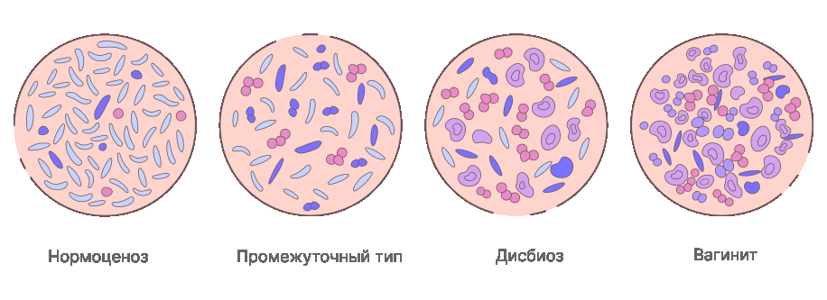 Типы биоценоза