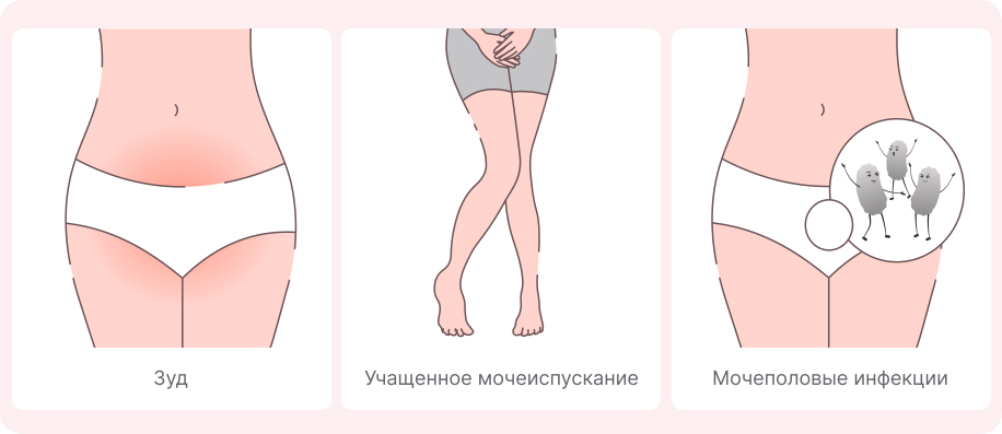 Симптомы сухости во влагалище