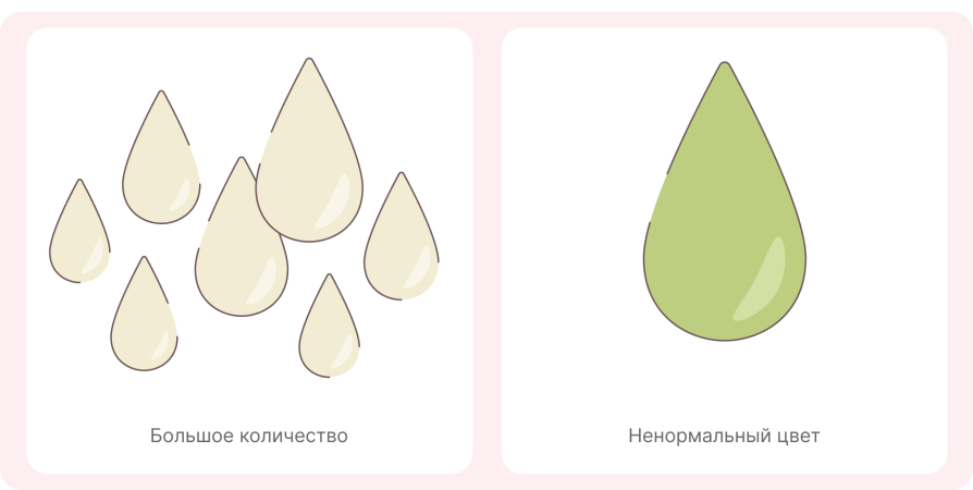 Критерии ненормальных выделений